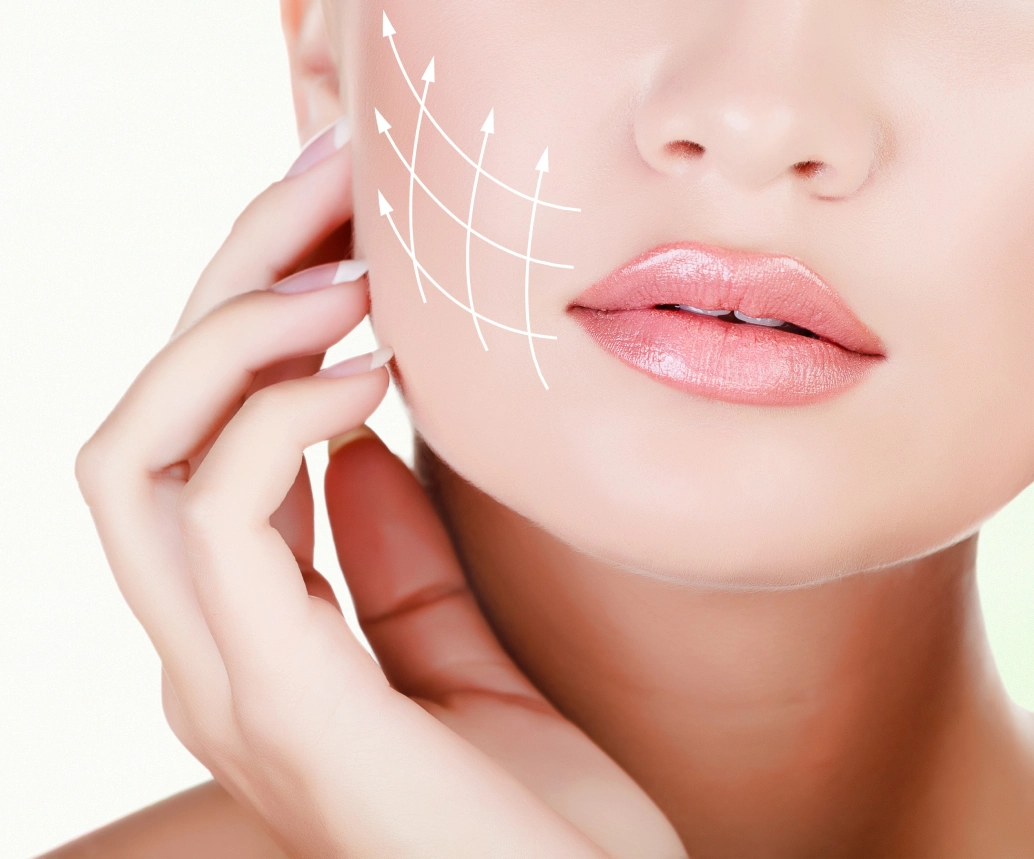 Close-up of a woman’s face marked for a laser skin treatment